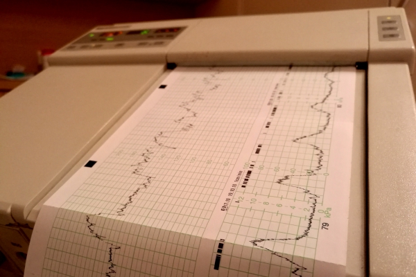 Kardiotokografie im Krankenhaus, über dts Nachrichtenagentur