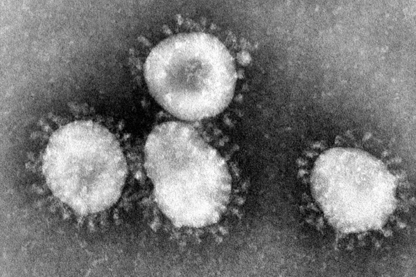 Foto: Coronavirus, über dts Nachrichtenagentur